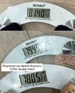 Схуднення з Мунджаро та супроводом нутриціолога на Лівому березі Києва