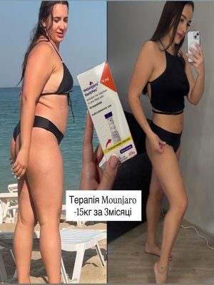 Терапія схуднення Мунджаро Mounjaro на Троєщині